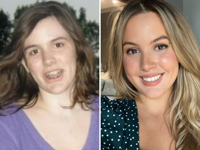 Обычные люди показали, как сильно изменились с возрастом